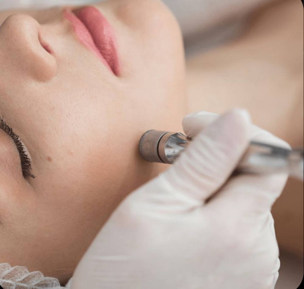 Mini Microdermabrasion Facial