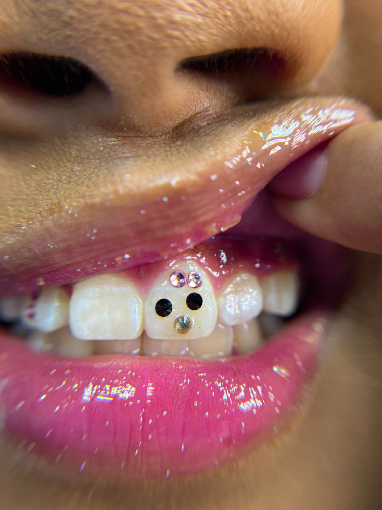 Hello Kitty Design Tooth Gems