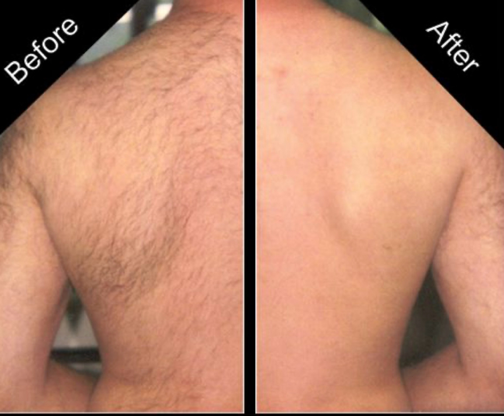 Back ( Full ) at Grandeur Spa in Merchantville, NJ