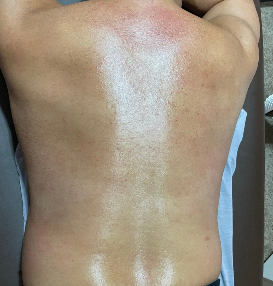 Back Wax