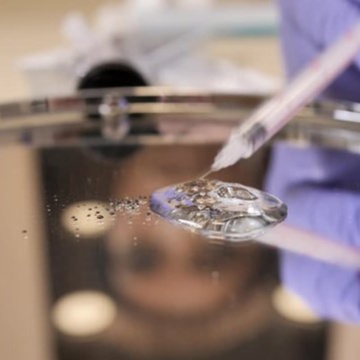 Hyaluronidase (Filler Dissolver) at Chateau  Aesthetics in Brownsville, TX