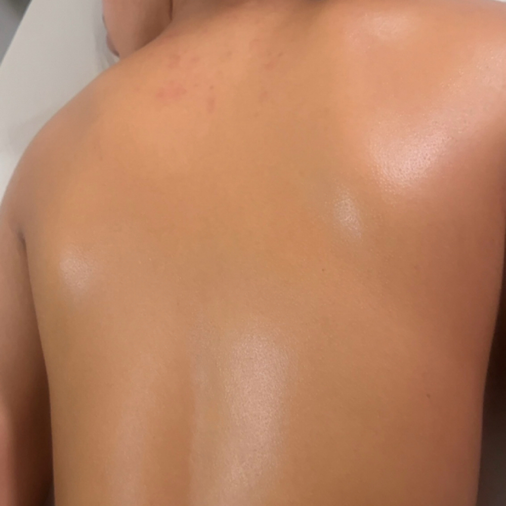 Full Back Wax at M. Rose Esthetics in Lake Elsinore, CA