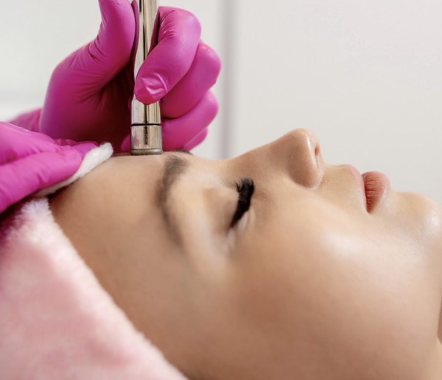 Microdermabrasion Facial