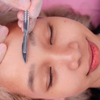 Dermaplane Facial at Embrace Skin Studio | Facials in San Francisco's Inner Richmond in San Francisco, CA