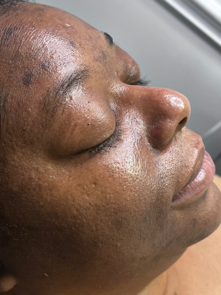 Virtual skin consultation