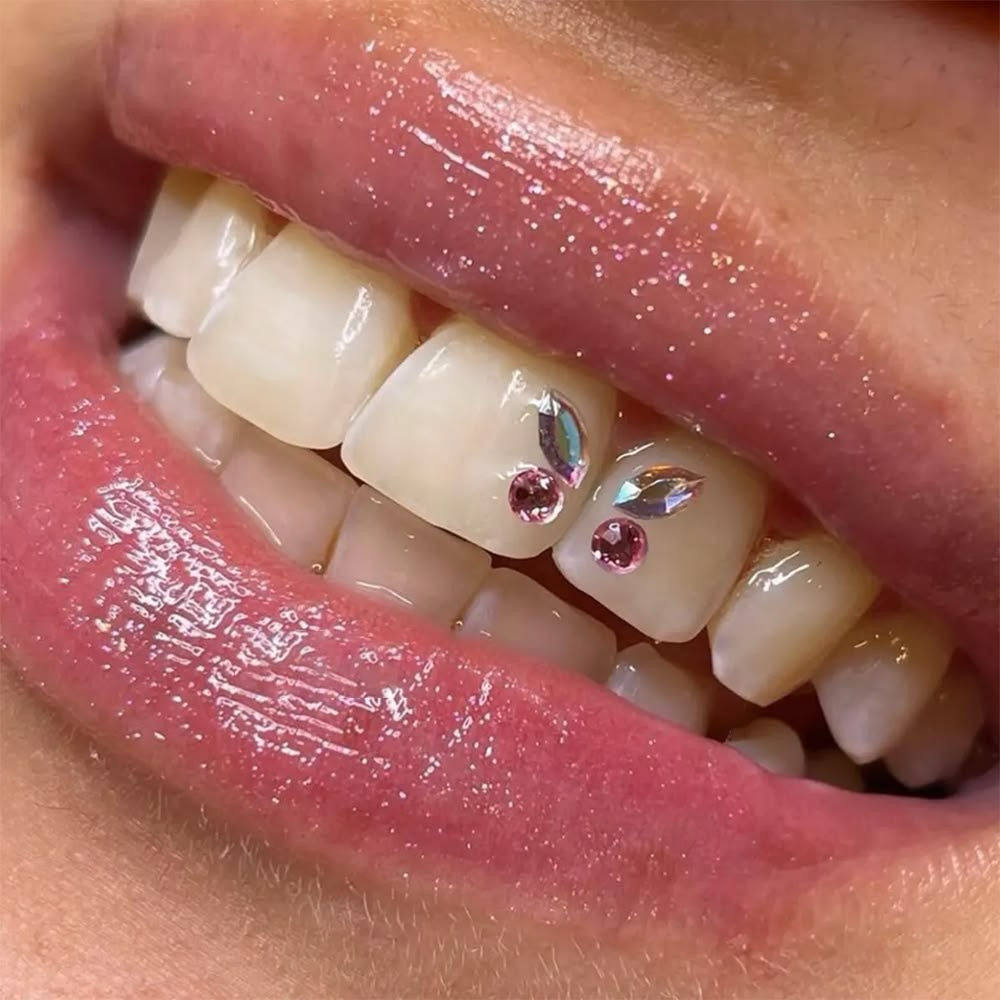 Tooth Gem(s) at Smiles by Mak in Casper, WY