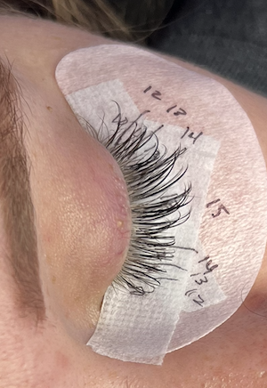 Maintenance fill - Hybrid at Garden Esthetics in Antioch, CA