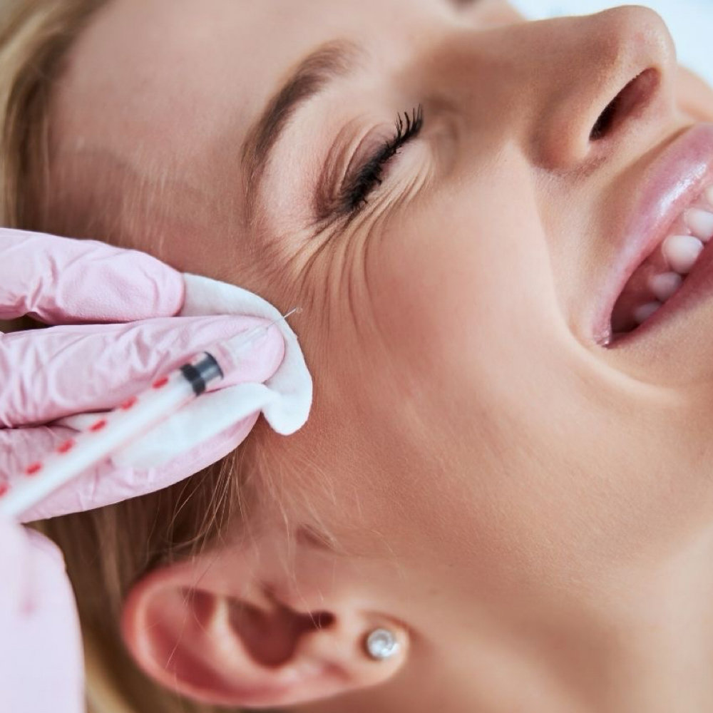 Crowsfeet Tox at The Skin Room Aesthetic and Wellness  LLC in Longview, TX