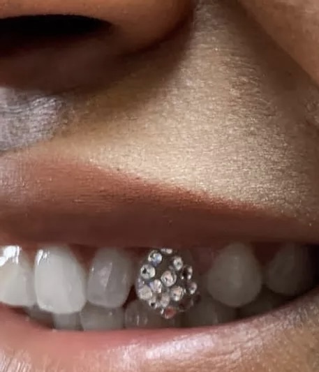 Disco Ball Tooth