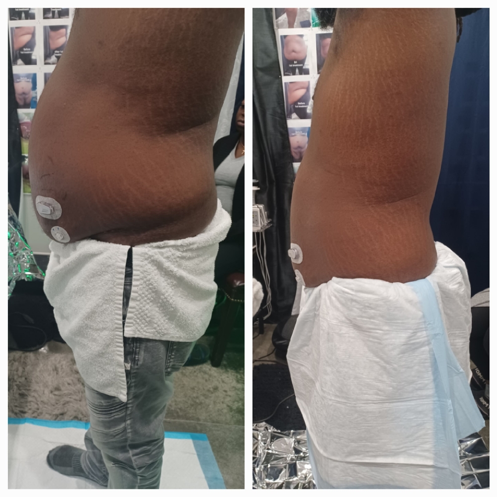 2 Sessions- 💜 StomachTreatment