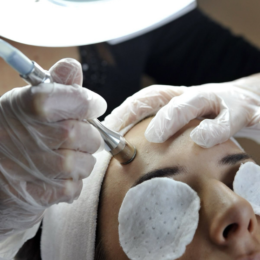 Microdermabrasion Add-On at Lex Esthetics in Sparks, NV
