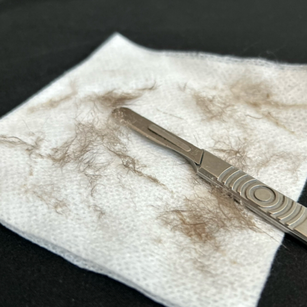 Dermaplane Add On at Dream Skin & Beauty in New York, NY