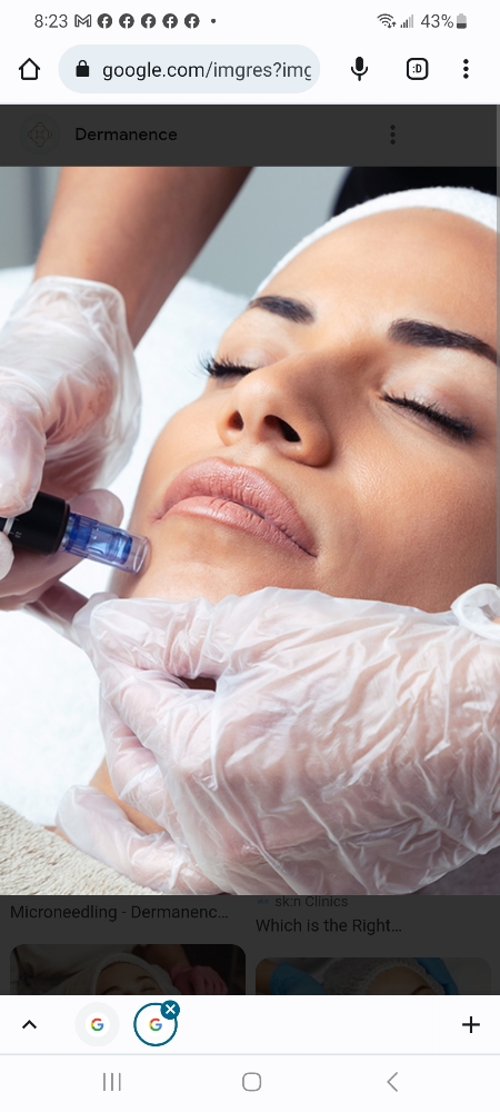 Microneedling