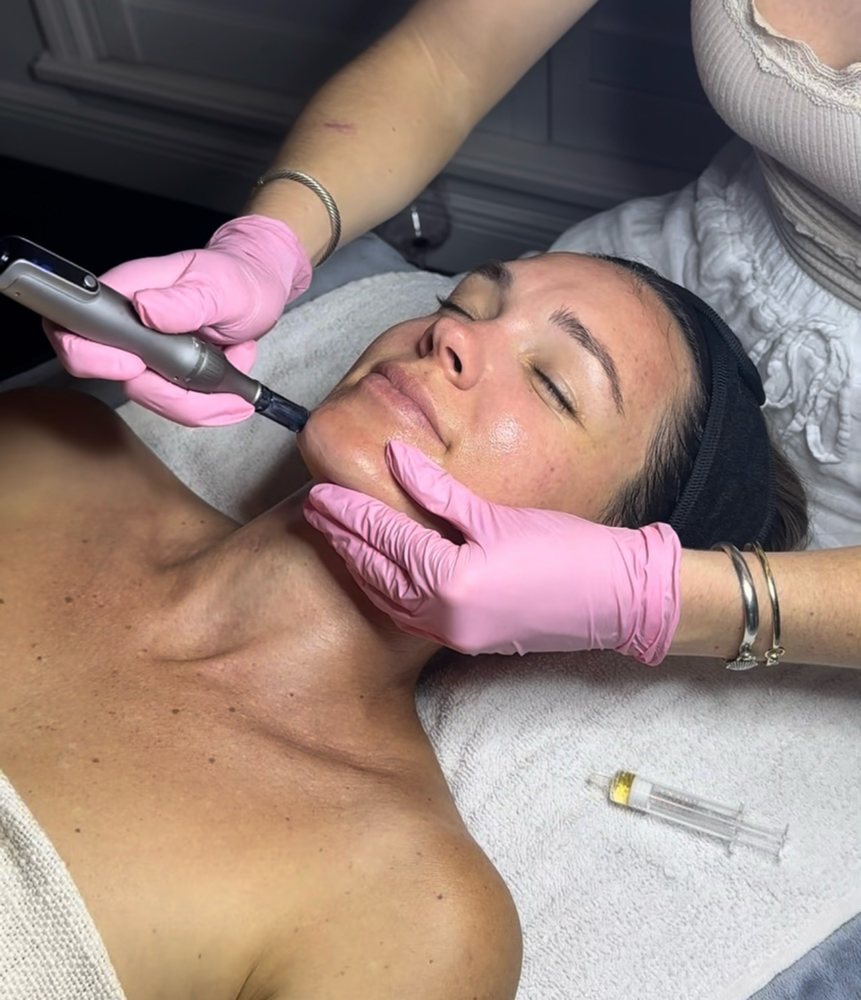 Nano-infusion + Salmon DNA