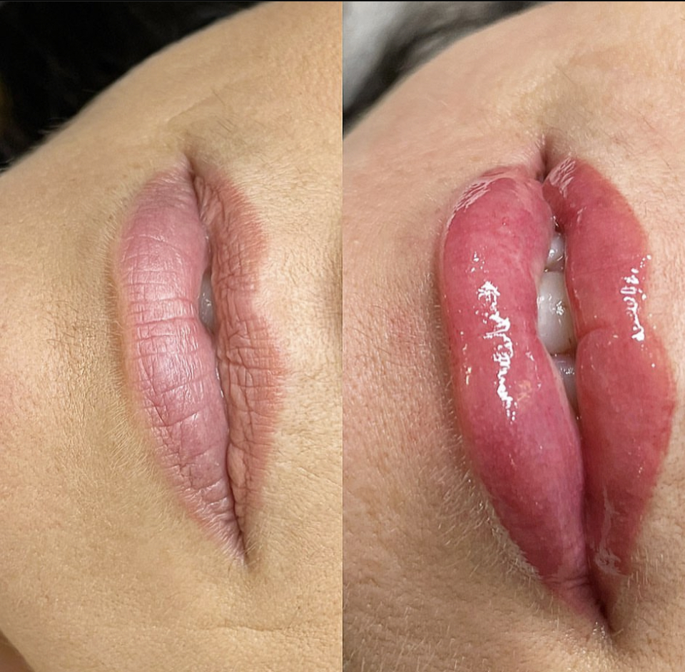 Lip Blush 18 to 23 months touch up