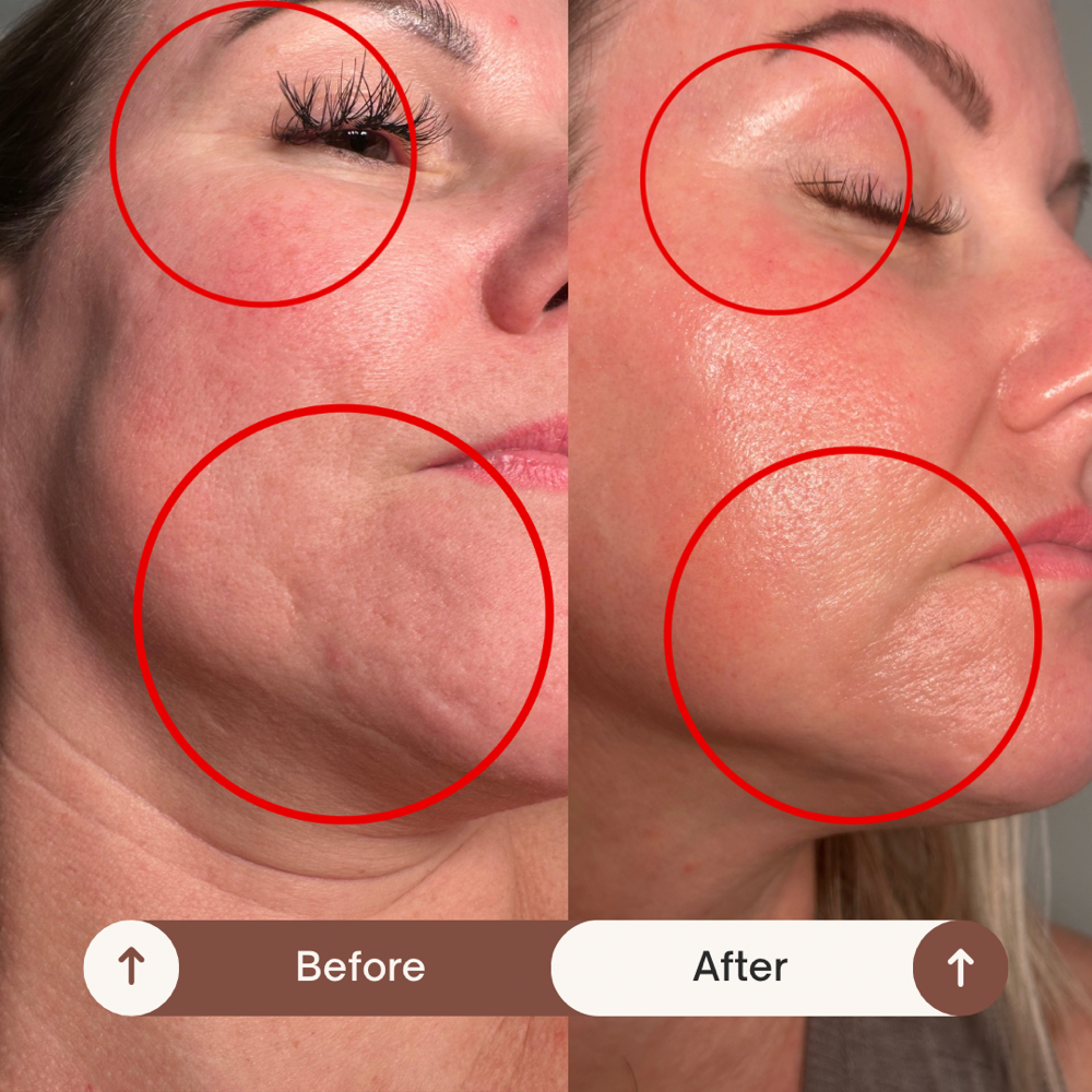 The Superior Peel Consultation