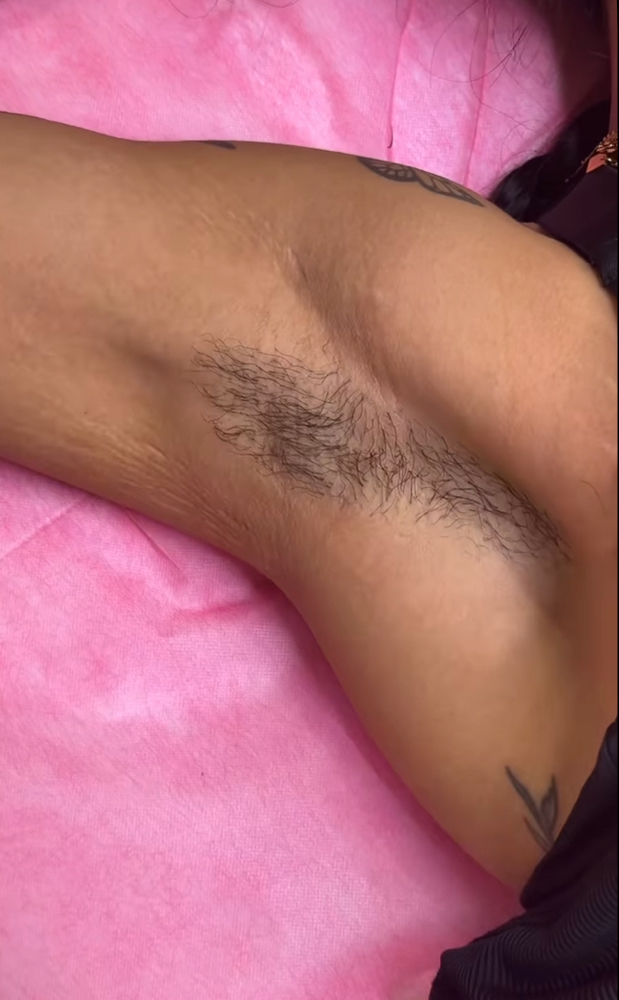 Underarms