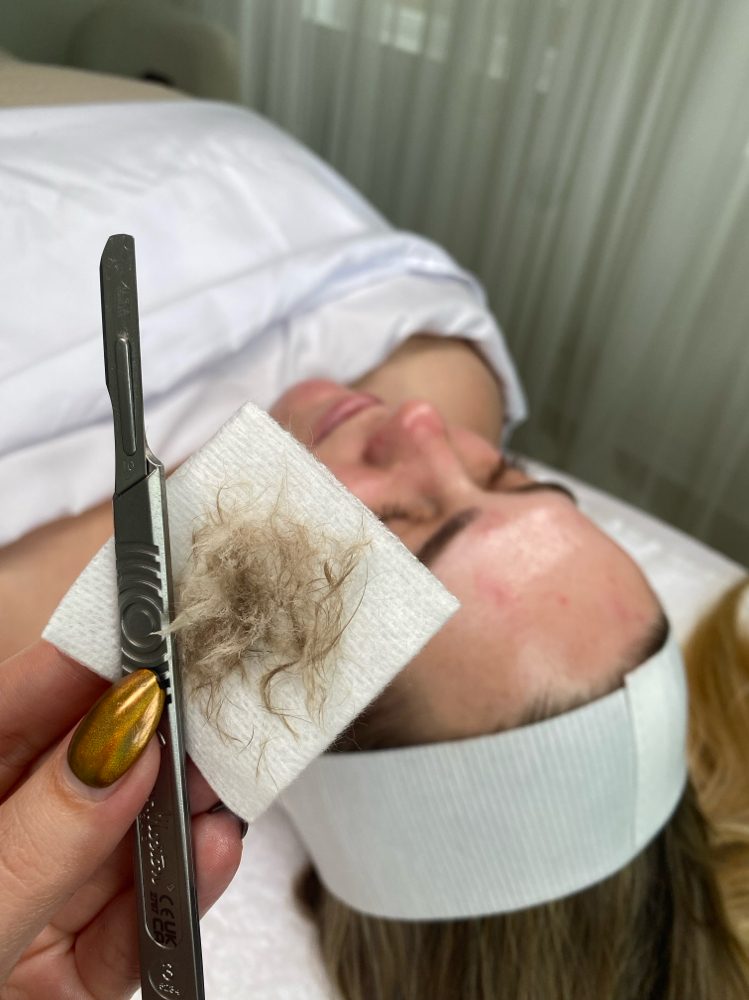 Dermaplane Add On