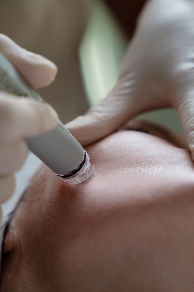 Hydrofacial