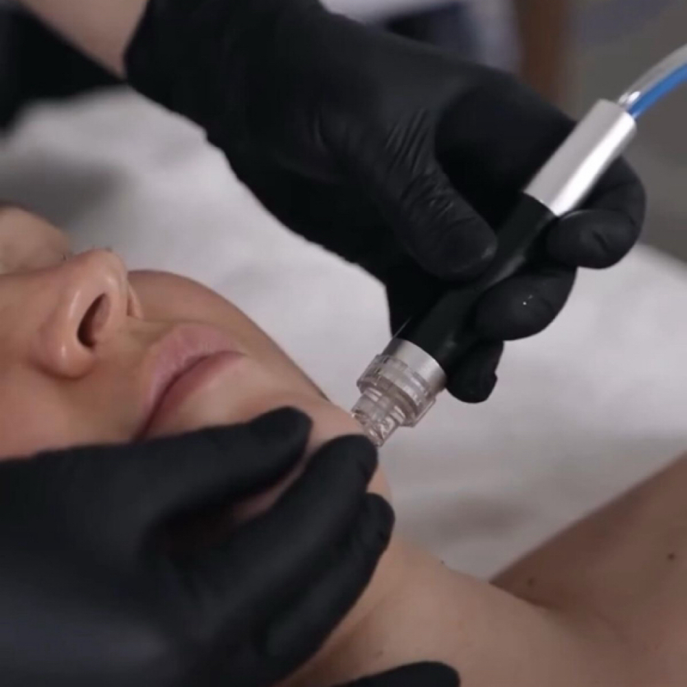 Hydrofacial Treatment at Waxed By Brittney in Modesto, CA