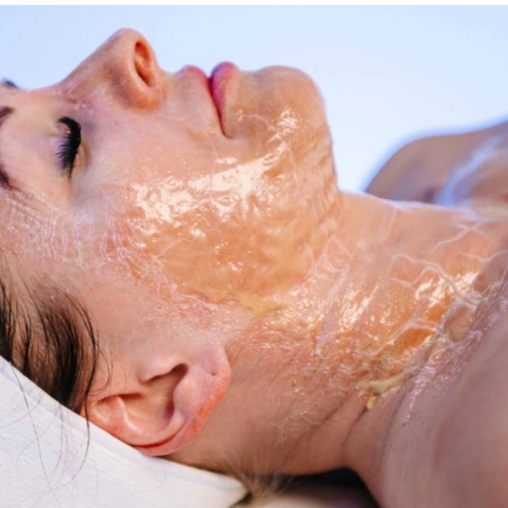 Botox Facial at Marta Rabelo Skin & Laser in Malden, MA