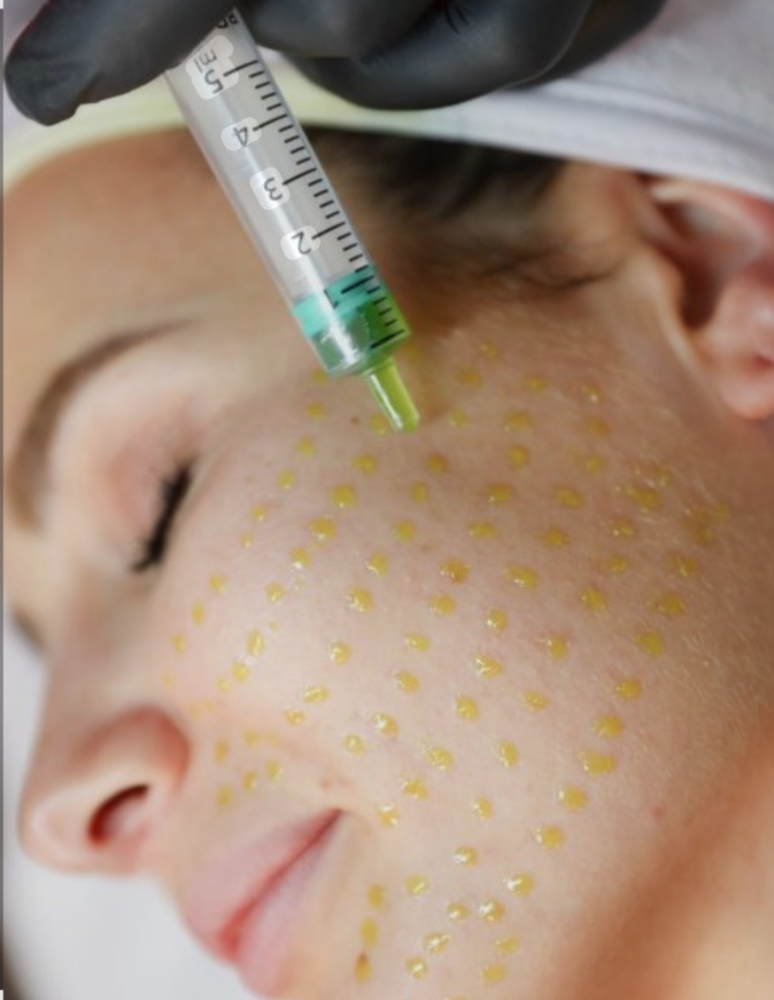 BioRePeel at CB Skin & Beauty in Tulsa, OK