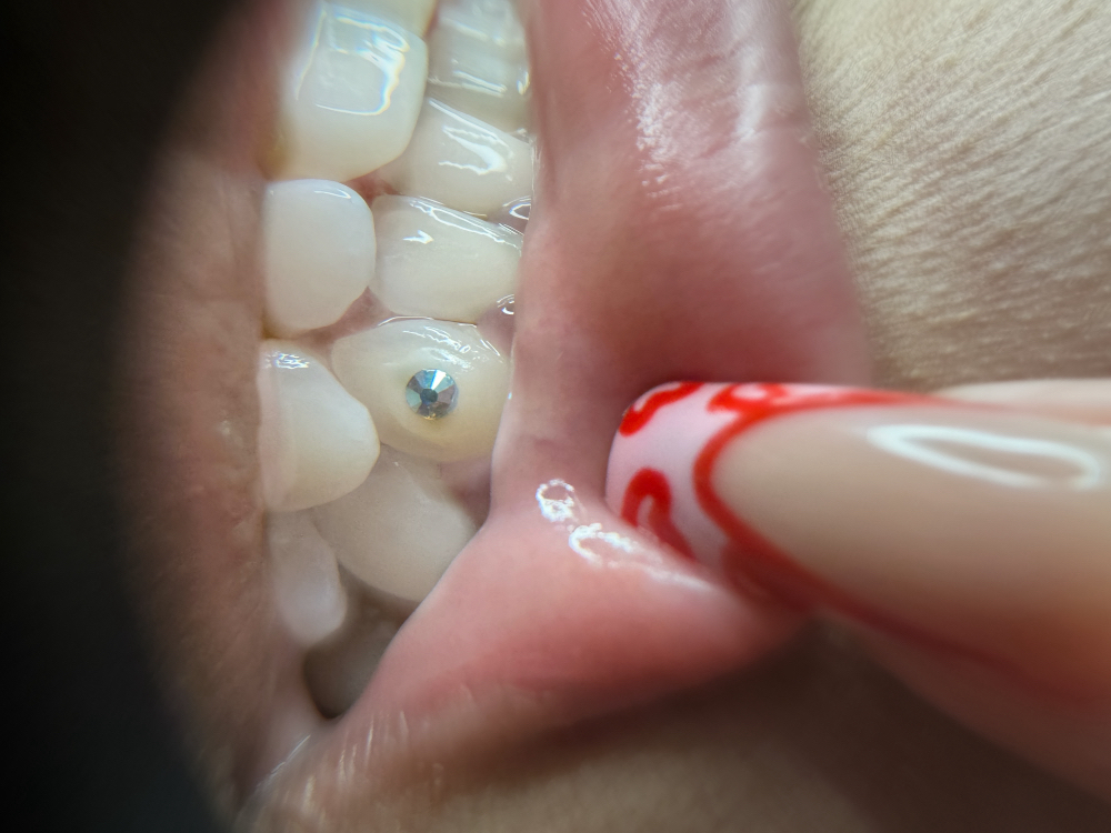 Swarovski Crystal Tooth Gem