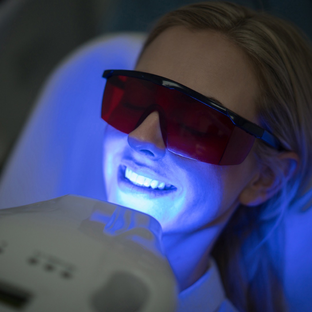 Advanced Teeth Whitening (Reg $250)