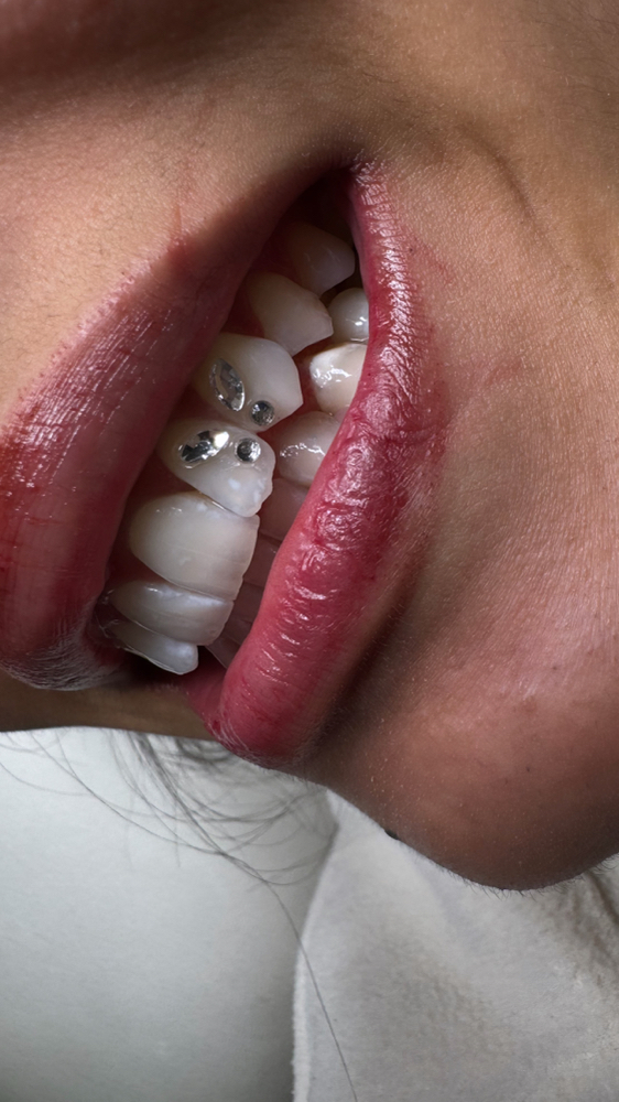 Tooth Gems at Utopia Beauté in El Paso, TX