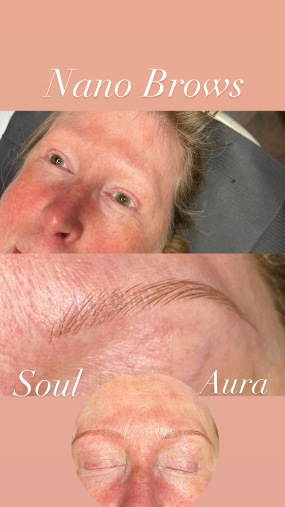 Colorboost (after 12-17 months)