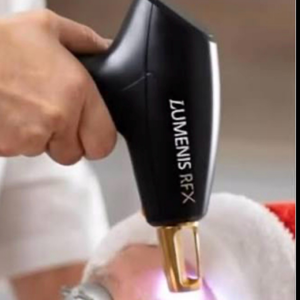 ResurFX Acne Scar Revision