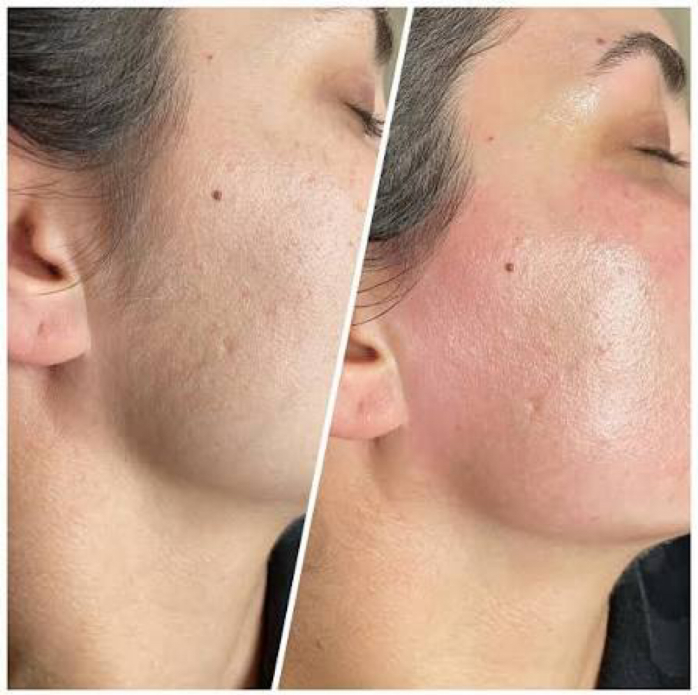 Full Face Wax at Angelic Skin & Body in Oak Park, IL