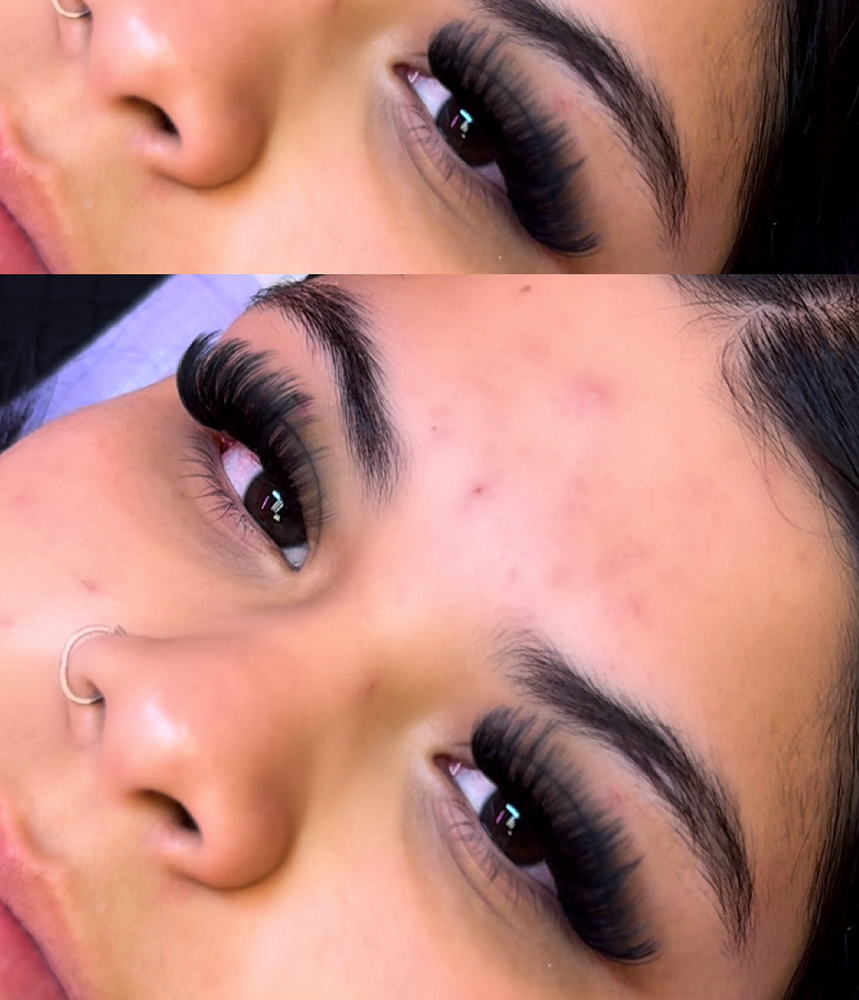 Mega Volume Fill