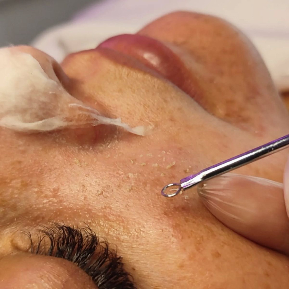 Deep Cleansing & Detox Facial at Luten&Co Beauty Studio in Woodland Hills, CA