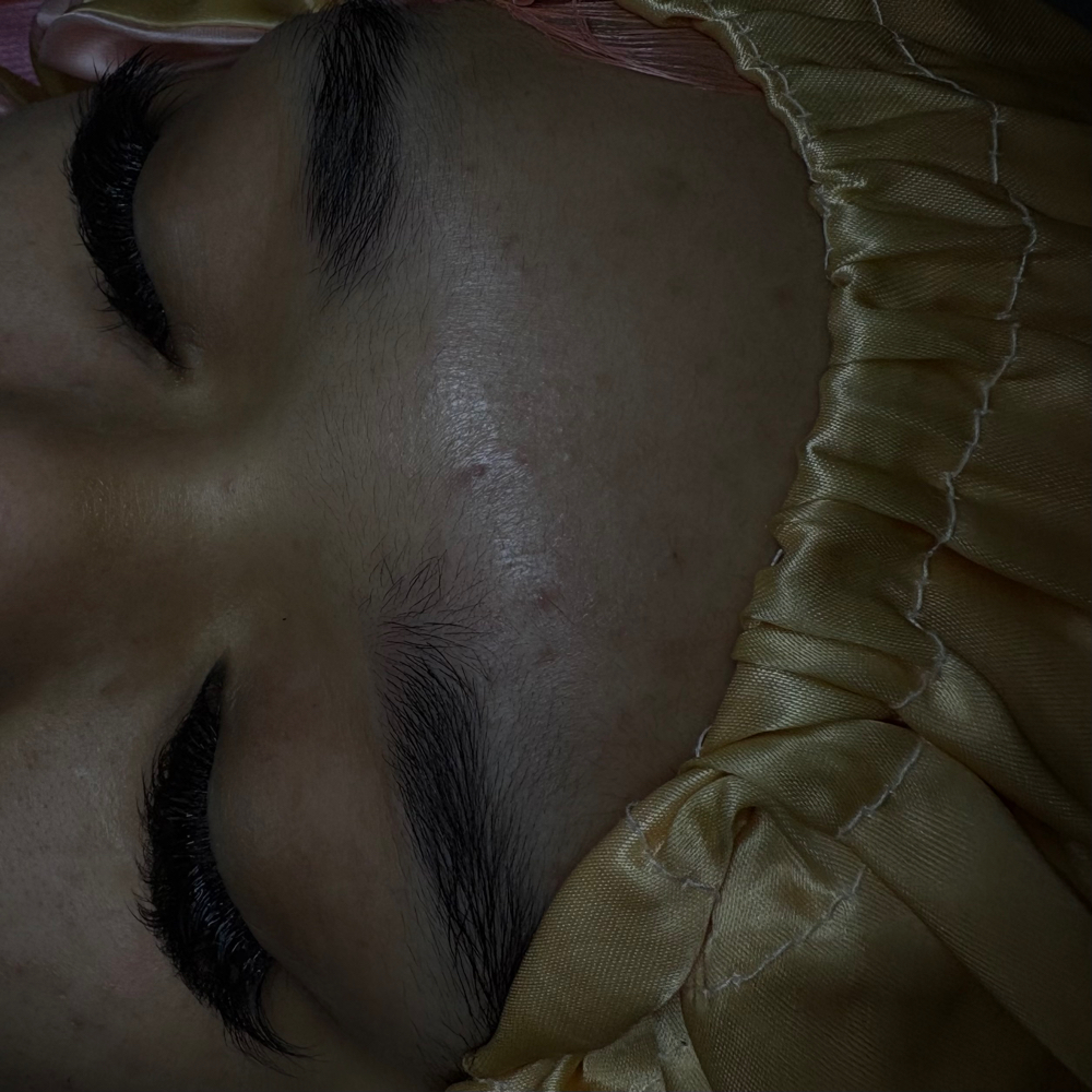 Lash removal