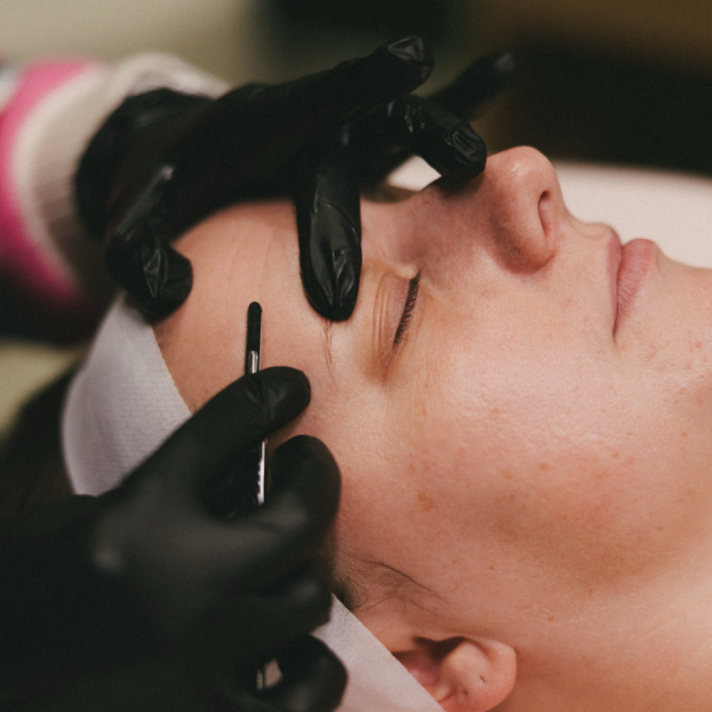 Dermaplaning Facial at Royal Esthetics in Kearney, NE