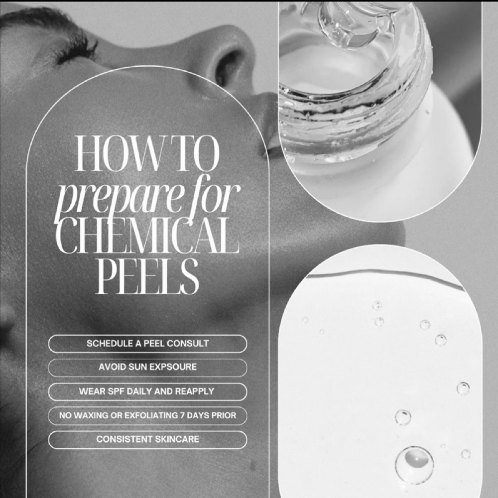 Custom Chemical Peel at Evara Studios in Pocono Pines, PA