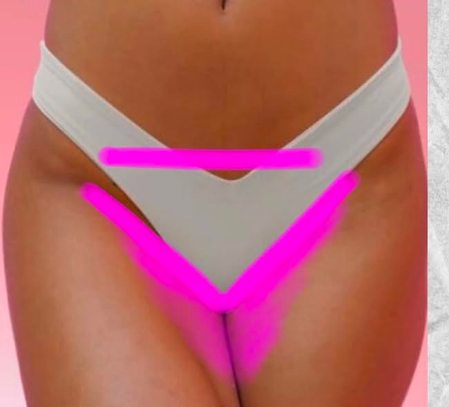 Bikini Line (Female)