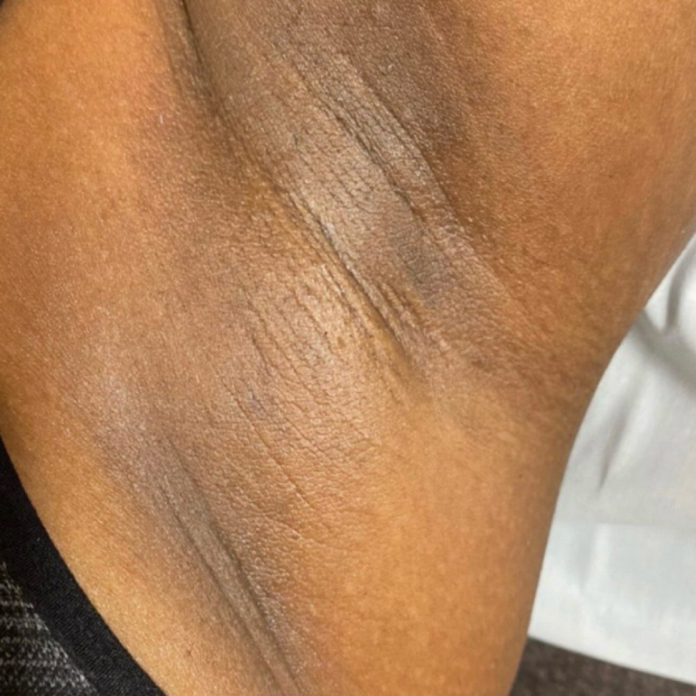 Underarm at PamperedByNaya in Ferndale, MI