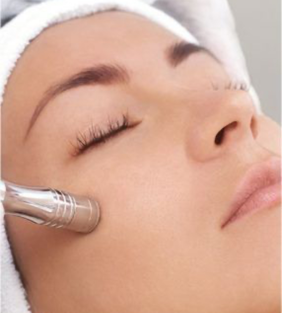 Mircrodermabrasion at Radiance by Caitlin in Greenville, SC