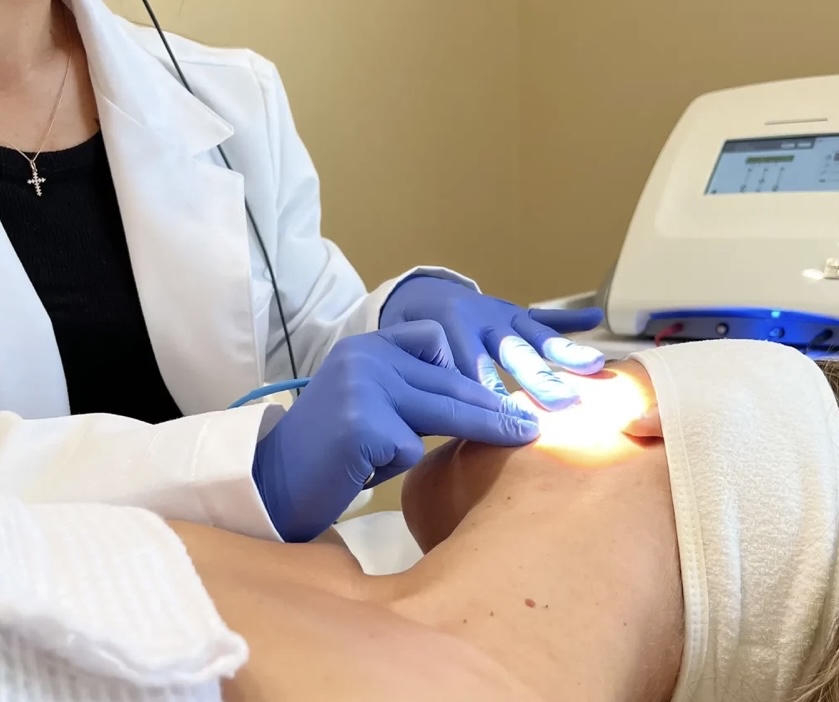 Electrolysis Consultation ~ Free