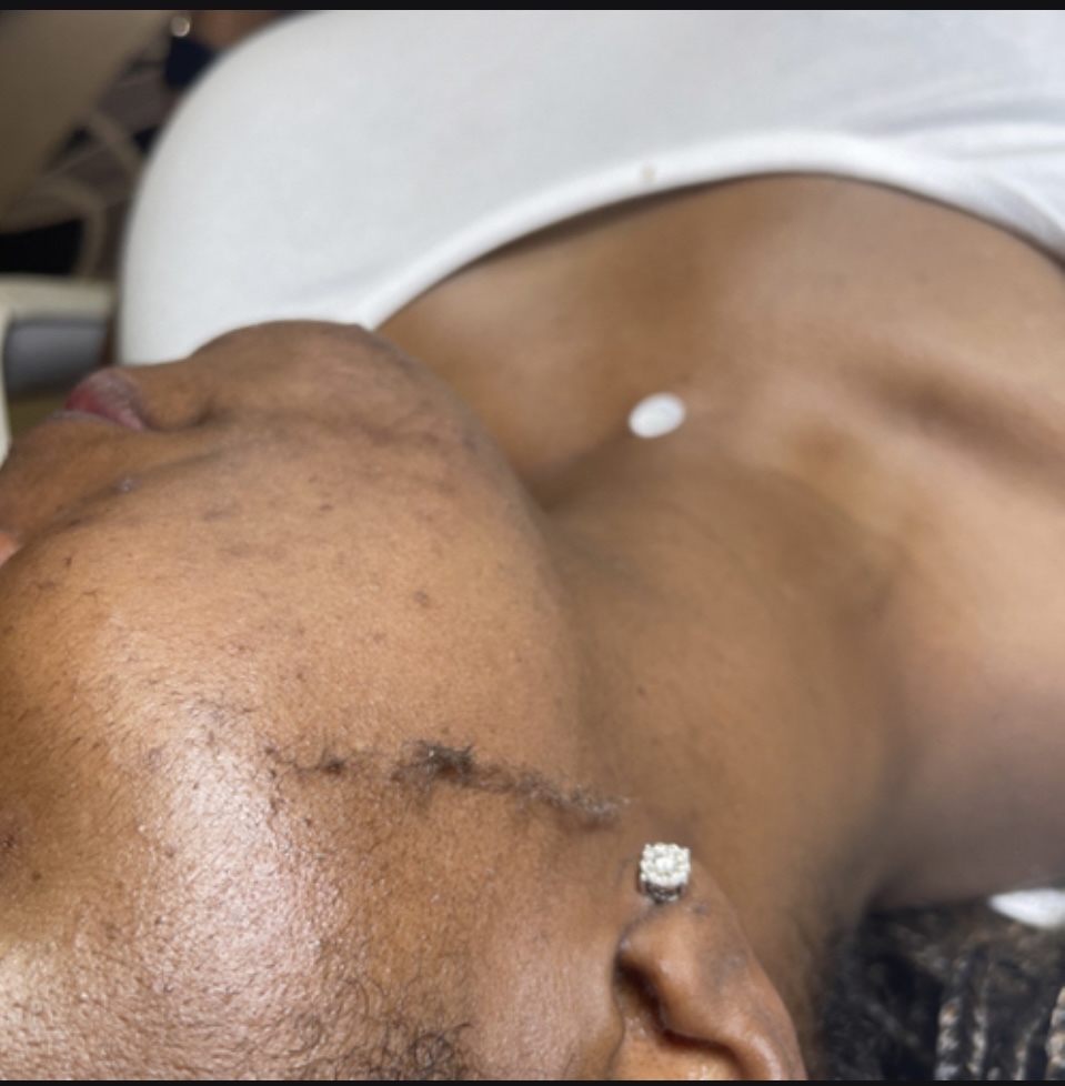 Dermplane Facial at Brookes Beauty Spa in Bay Springs, MS