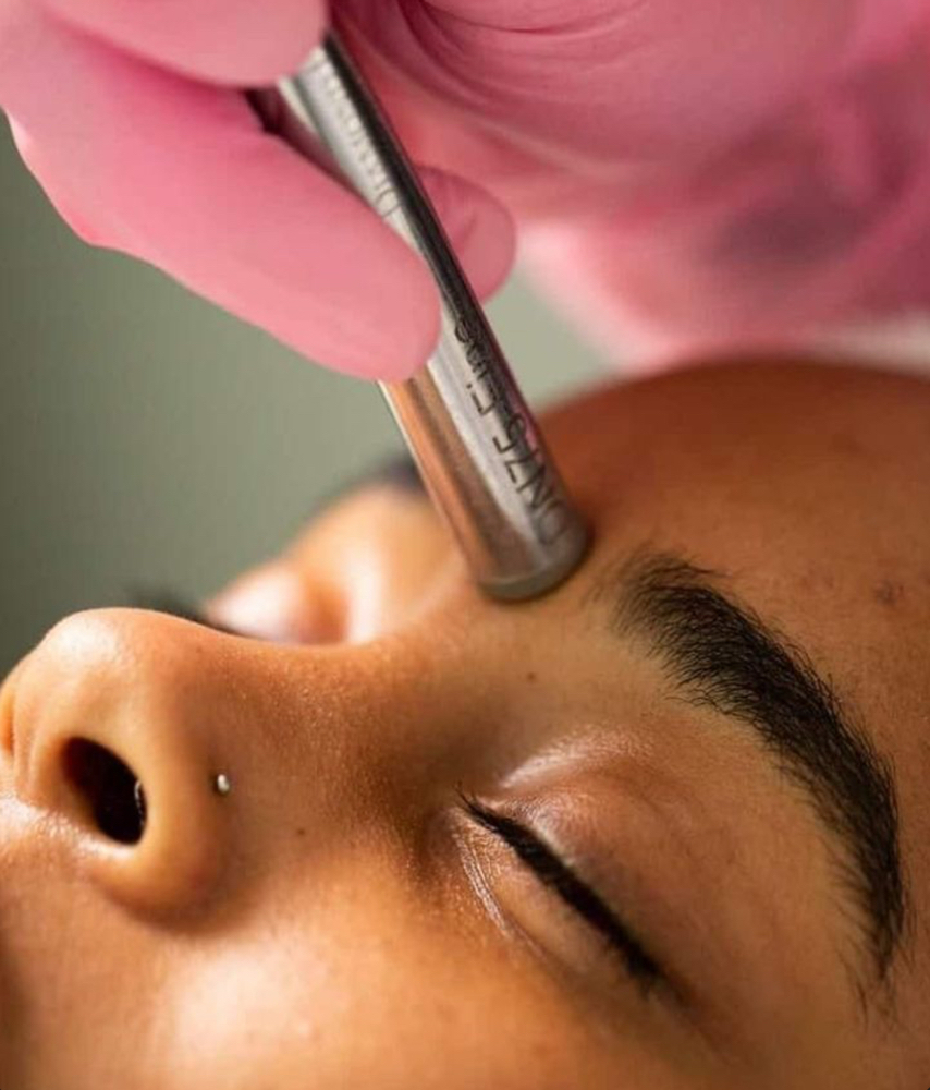 Microdermabrasion Treatment