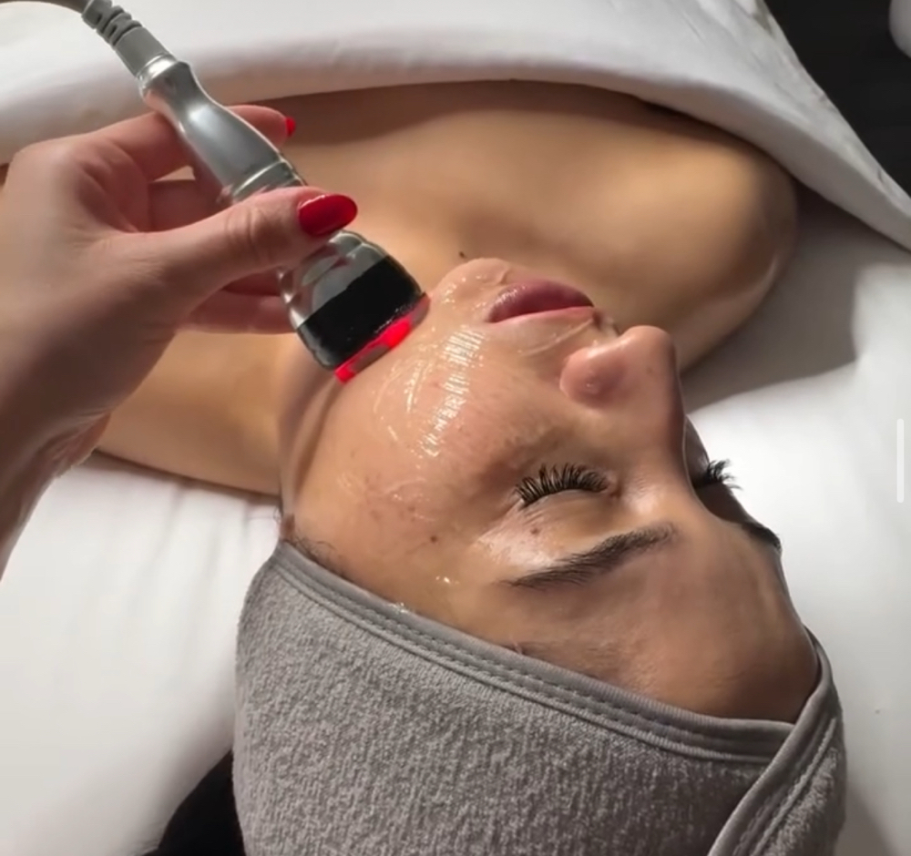 Electrical Muscle Stimulation