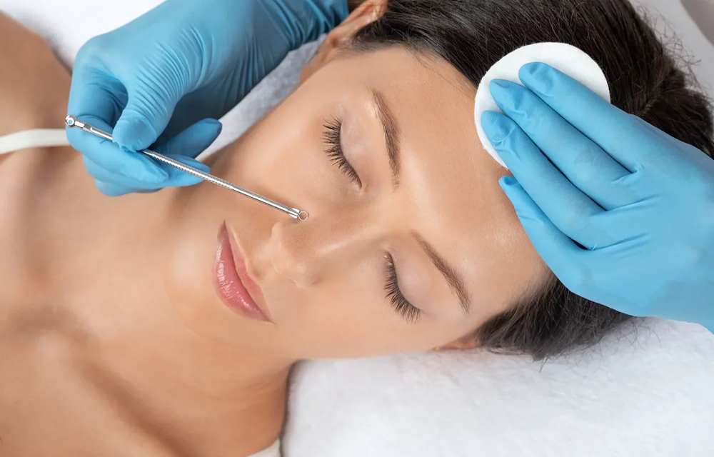 ADD ON - Extractions at Candice Marie Esthetics in Yardley, PA