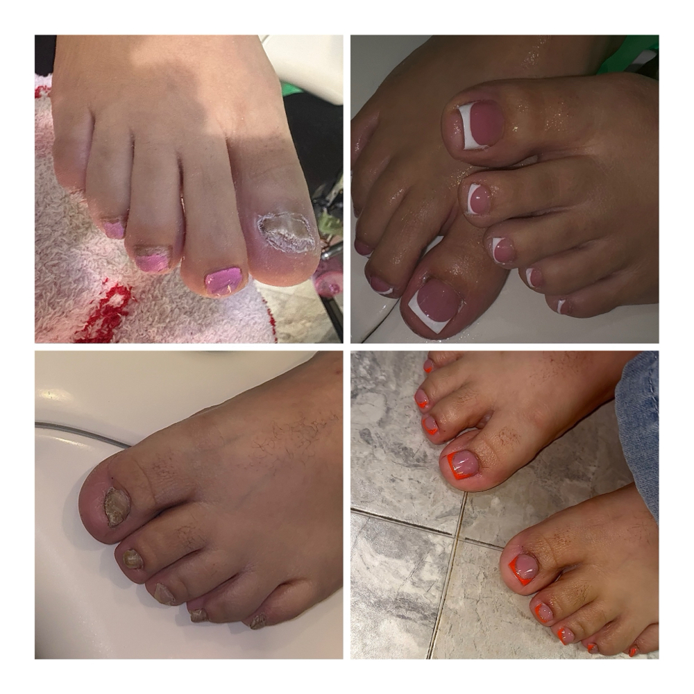 TOE BBL / RECONSTRUCTION at Alenna’s Acrylics in Bay City, TX