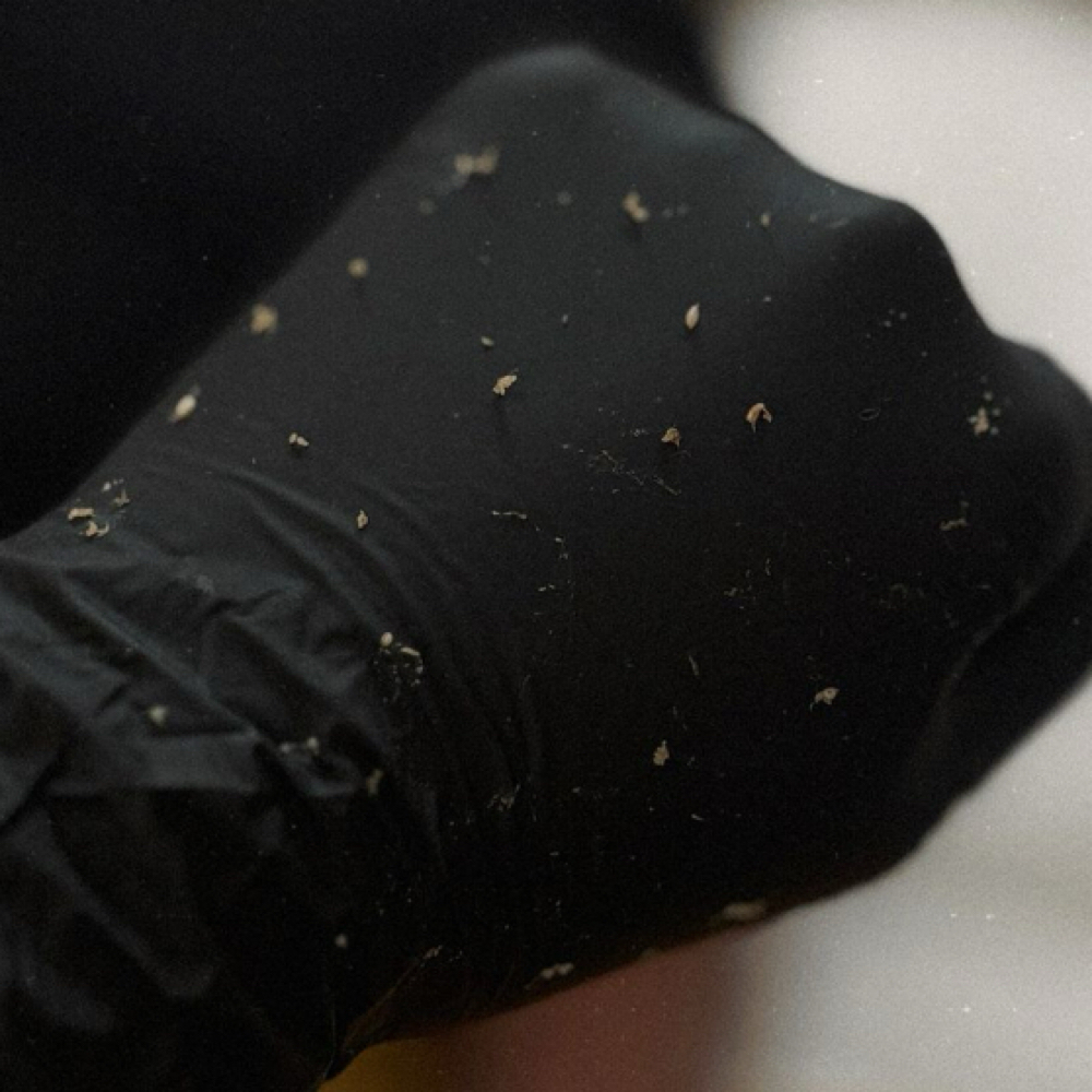 Ingrown Removal at Ama Aesthetics Studio in Methuen, MA