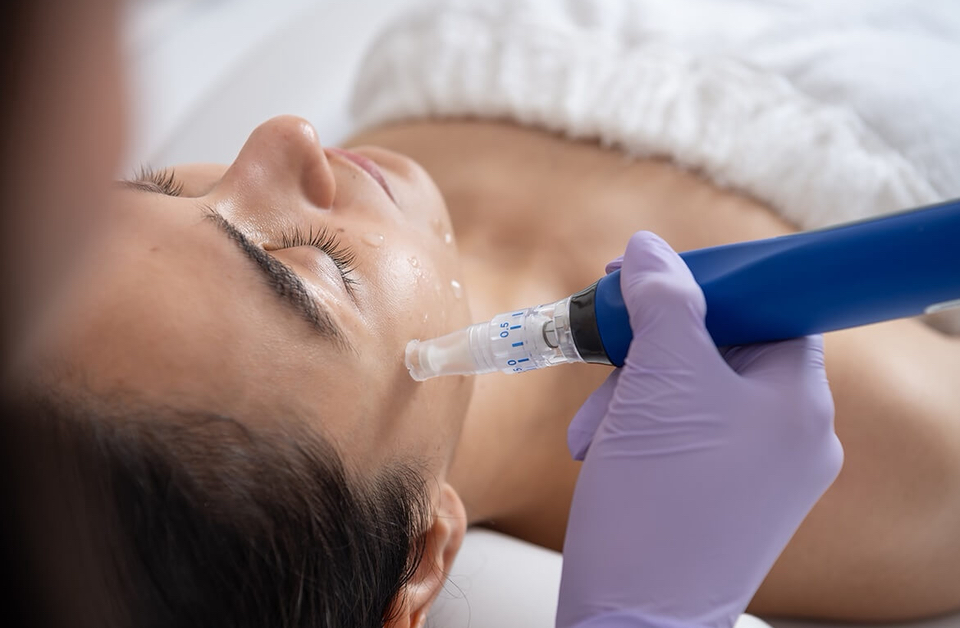 Microneedling, Dermaplaning & Mask at Younger Face and Body in Katy, TX