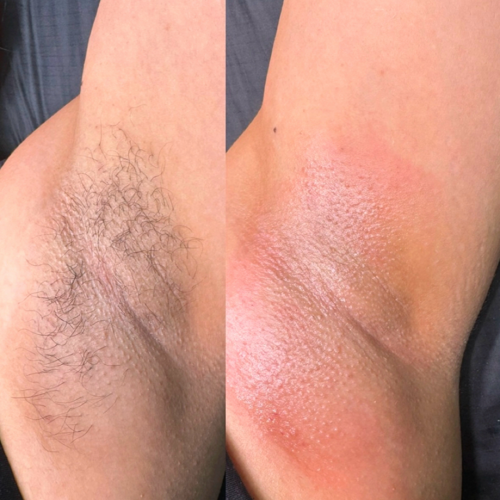 Underarm Wax at Endlessbeauty in Ceres, CA