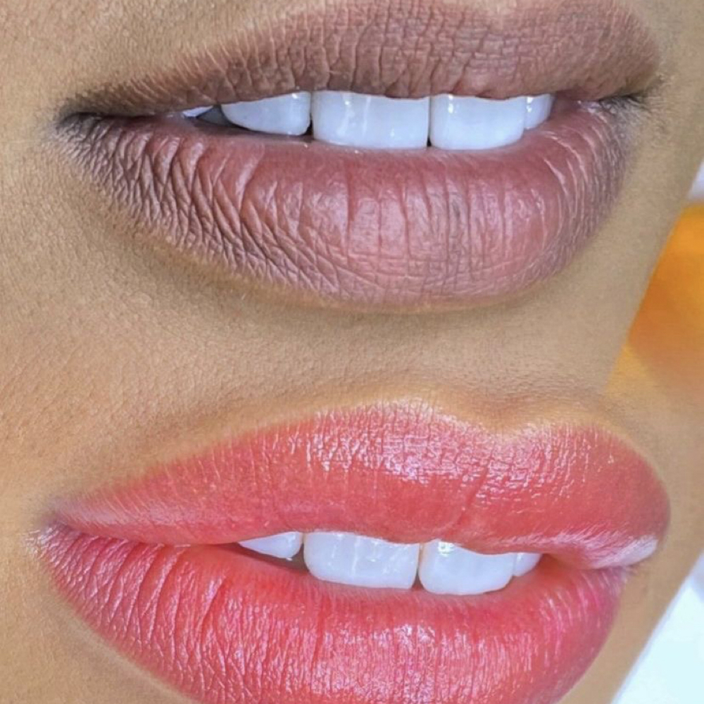 Dark Lips Neutralization at brow2brow.pmu in San Jose, CA
